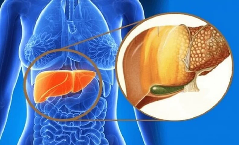 کبد چرب را با این روش به‌راحتی درمان کنید