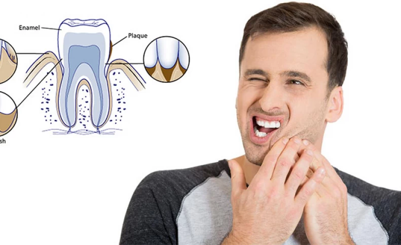 Understanding Teeth Sensitivity: Causes, Symptoms, Treatments, and Prevention